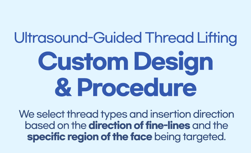 Custom design Lienjang difference